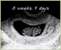 Weeks 4 days ultrasound 4 Early Pregnancy