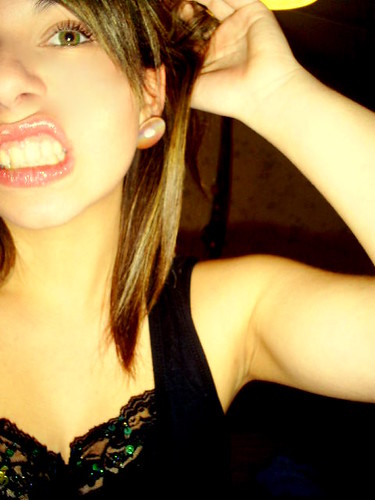 Botox  :O | by Denisse rovagna