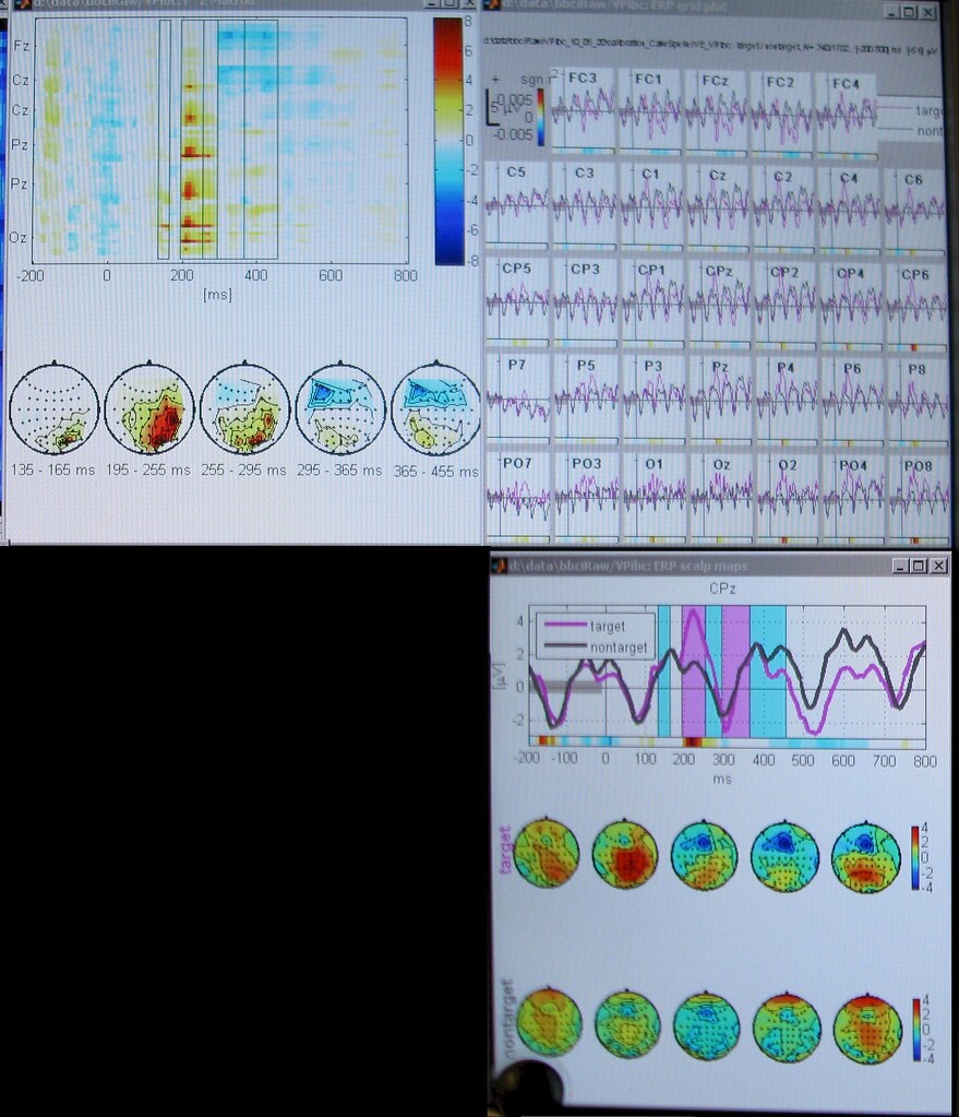 brain EEG activity, visual-spatial processing - a photo on Flickriver