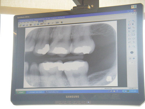 My x-ray | by tiffs pictures