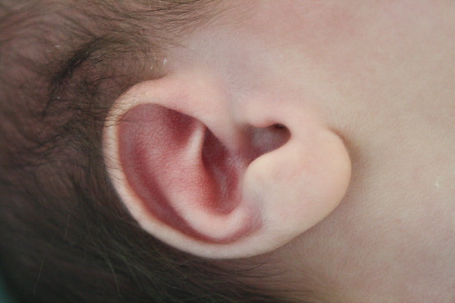 Kieran's ear