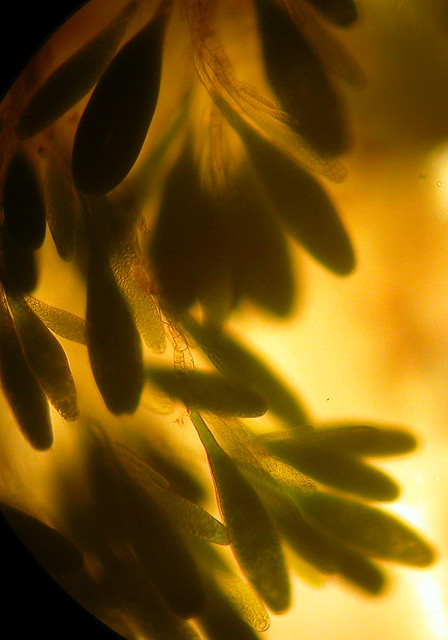 Strange algae magnified under microscope
