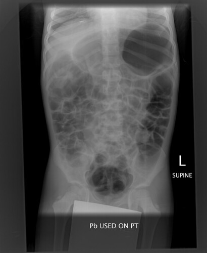 xray abdomen | by someclimber