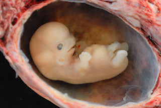 Embryo @ 6- 7 weeks | by lunar caustic