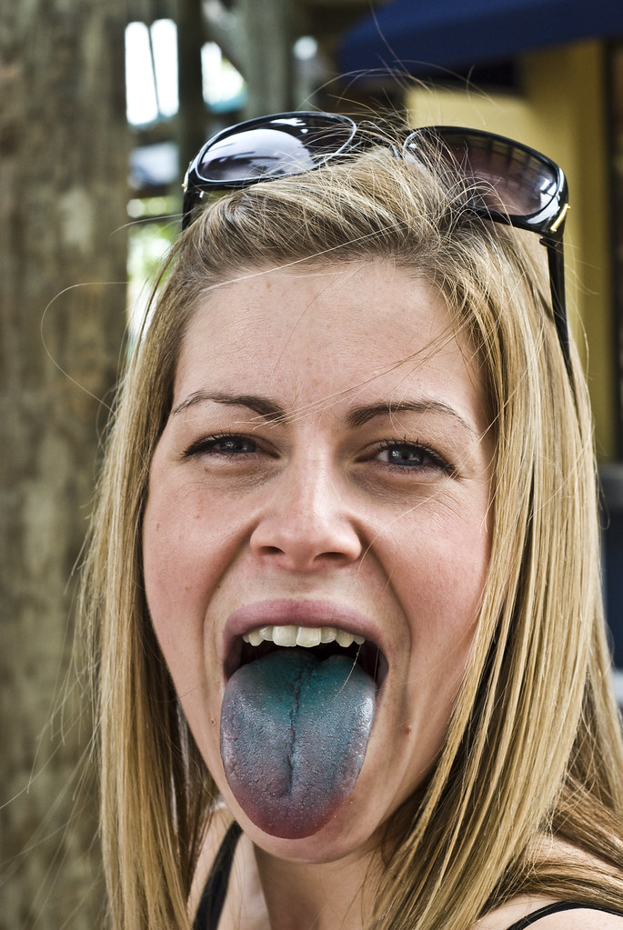 Florida 2009 Steph comes down with blue-tongue.