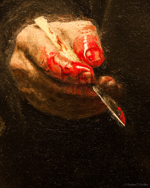 The Surgeon's Hand