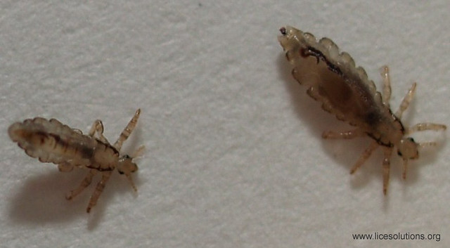 Head Lice - Louse with Third Stage Nymph