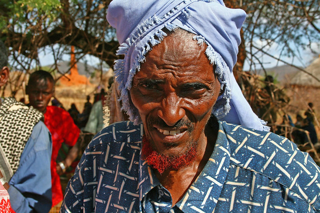 Ethiopia - displaced person
