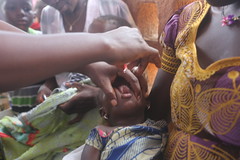 World Polio Day in Guinea