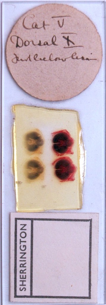 Sherrington's Box Drawer 12, Row 2, Slide 11