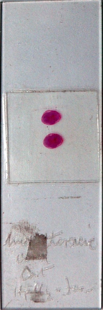 Sherrington's Box Drawer 11, Row 2, Slide 6