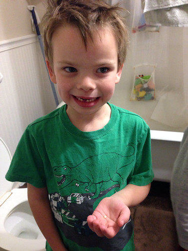 02/07/14 | Big milestone! Linus lost his first tooth! He was… | Flickr