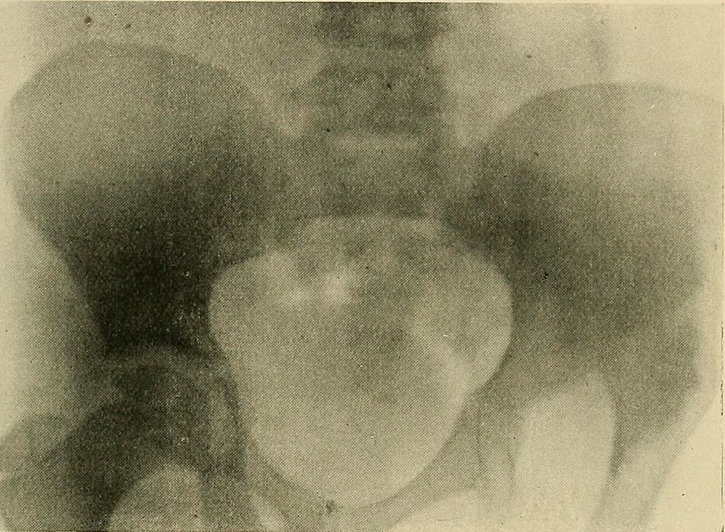 Pan Röntgen Image from page 256 of