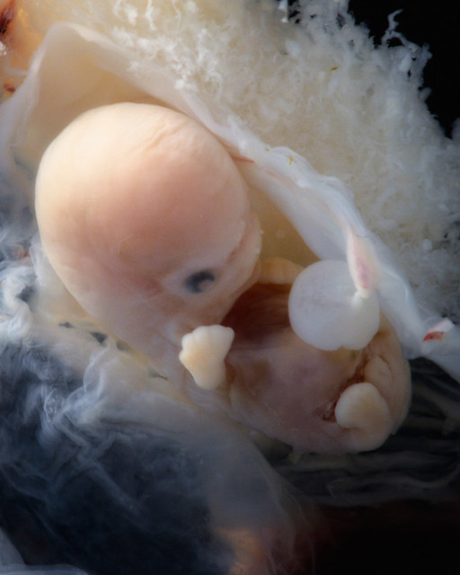 Embryo at approximately 7 weeks EGA