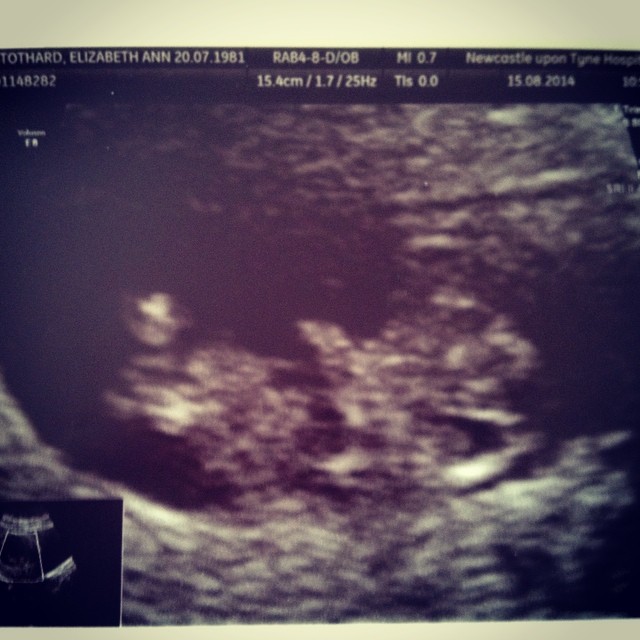 A baby. Inside me. #holyshit #pregnant