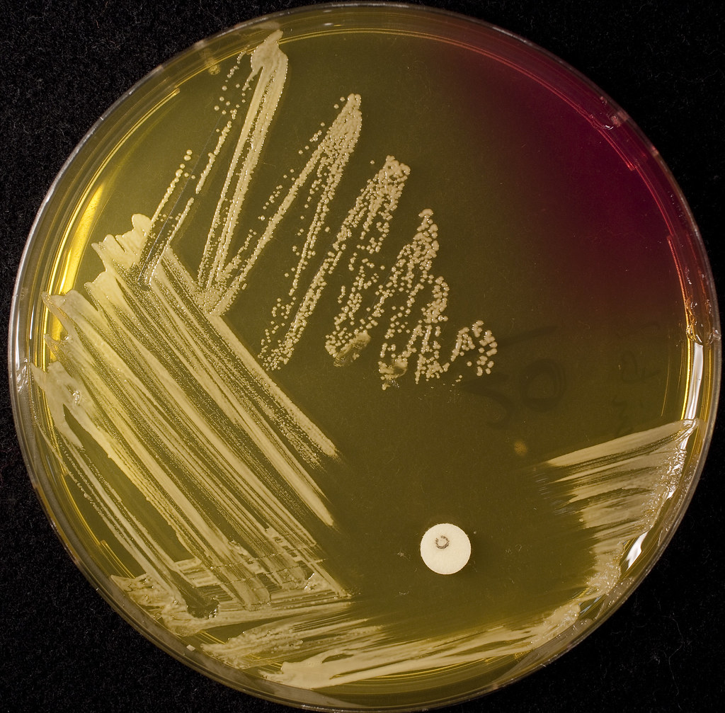 Staphylococcus aureus среда. Сапрофитный стафилококк на ЖСА. Сапрофитный стафилококк Staphylococcus saprophyticus. Стафилококки ЖСА золотиская. Золотистый стафилококк на ЖСА.