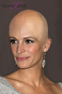 Bald and the Beautiful: Julia Roberts | BeautyXpose | Flickr