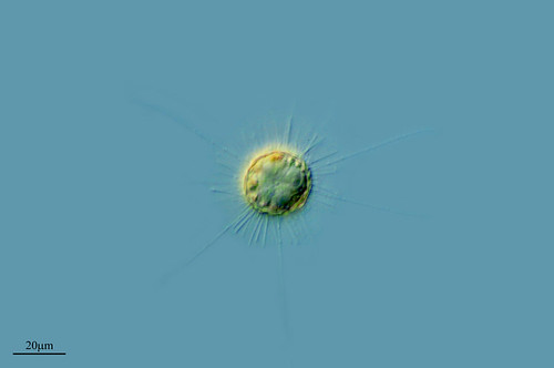 ACANTHOCYSTIS by PROYECTO AGUA** /** WATER PROJECT