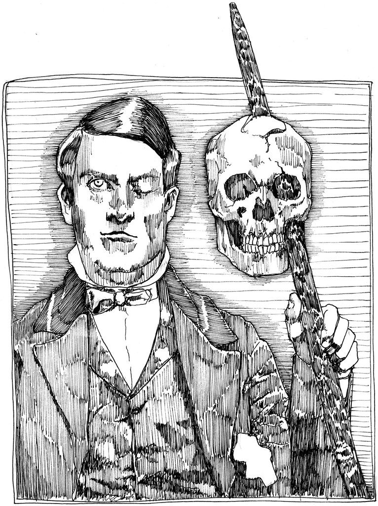 Phineas Gage Displays His Own Skull.