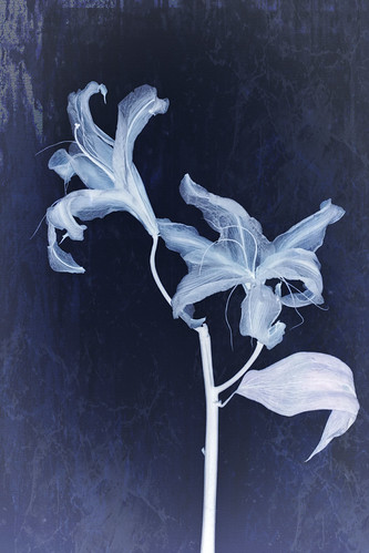 xray | by carlosfc1