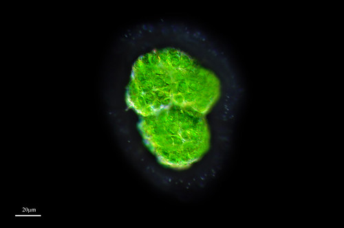 BOTRYOCOCCUS, NUBE VERDE by PROYECTO AGUA** /** WATER PROJECT