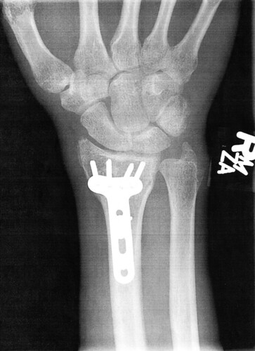 Xray 4 | by Left Coast Camera