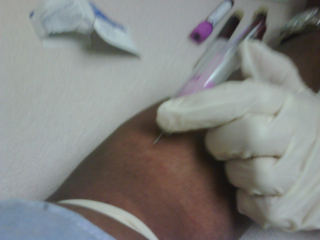 Ouch Giving Blood