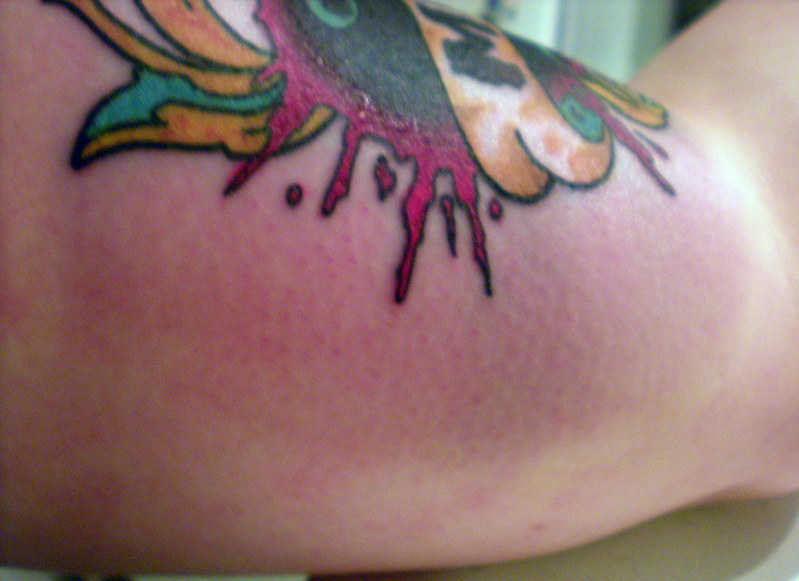 tattoo swelling 3 | Kim Laurenson | Flickr