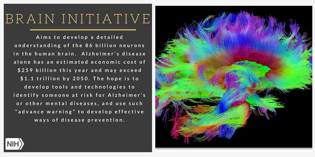 prevent Alzheimer's