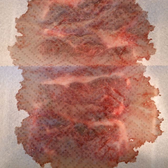 Viewer's Choice: Rorschach inkblot test - OR - Four raw steaks under a paper towel (October 2010)