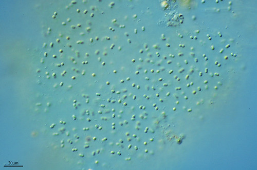 LA CIANOBACTERIA APHANOTHECE STAGNINA by PROYECTO AGUA** /** WATER PROJECT
