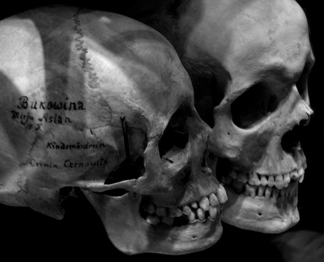 Child murderer's skull