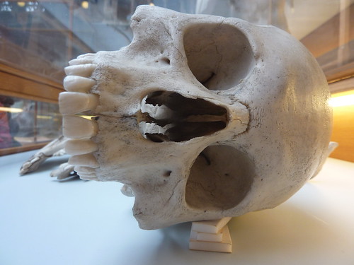 Nice human skull! | by ♫ Claire ♫