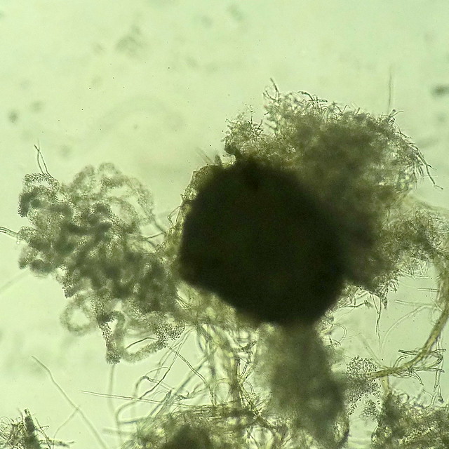 Phoma sp.: Pyncidium, center, discharging a snakelike stream of conidia, left (i.e., spores)