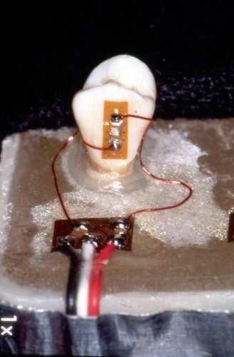 January 26, 2017 - 6:20pm - Here, two EA-06-015EH-120 strain gages are installed on a dental implant.  Though two gages are used on opposite sides, this installation is not a half-bridge.  Instead, the two gages are wired in series as a quarter-bridge.  This arrangement provides automatic sensitivity only to the axial strain, while cancelling unwanted strains due to bending.  Self-temperature-compensation number (STC) was not critical since temperature changes did not occur during the course of the strain measurements.