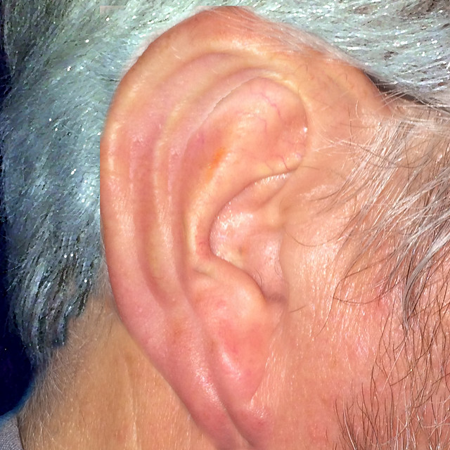 My Listening Ear