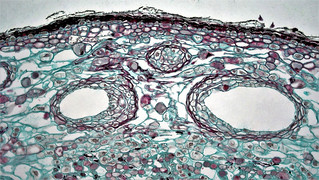 Gymnosperm Stem: Cortical Resin Ducts in Four Year Pinus