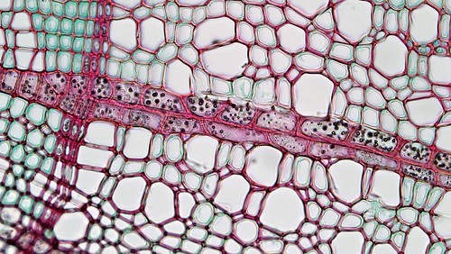 Multiseriate Rays Woody Dicot Stem: Multiseriate Rays in Four Year Liriodend… | Flickr