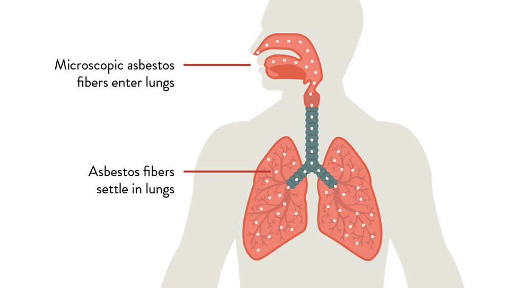 what is the difference between mesothelioma and asbestosis