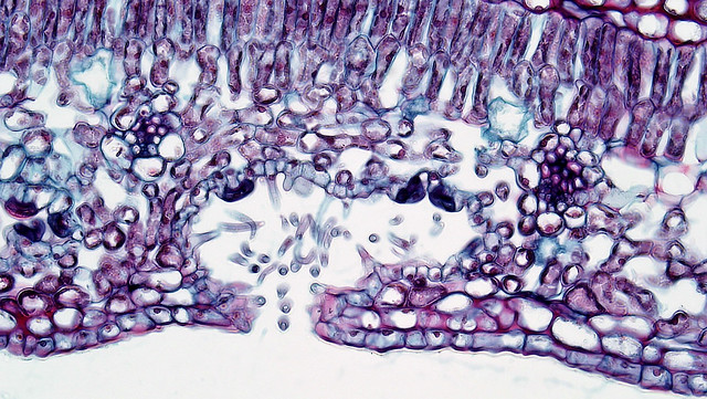 Angiosperm Leaf: Secondary Vascular Bundles in Nerium