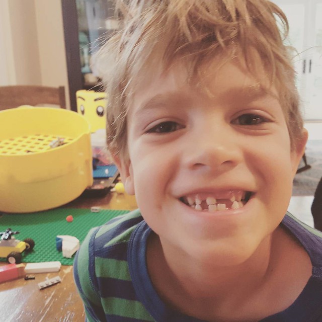 Someone is keeping the Tooth Fairy busy.