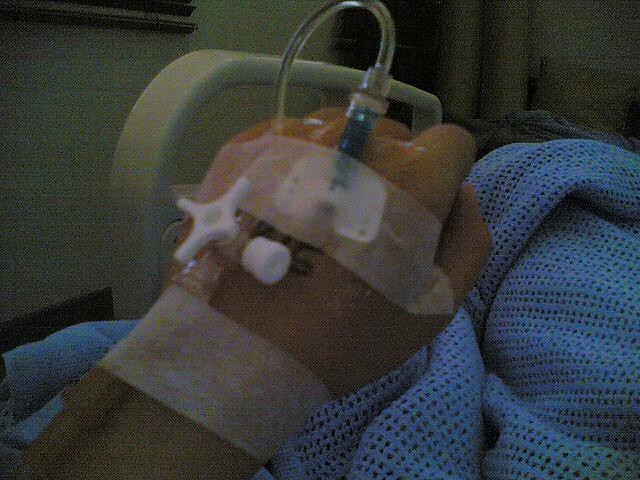 Intravenous Drip In Hand