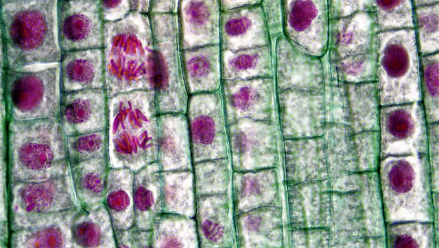Mitotic Stages in Apical Meristem of Allium Root Tip