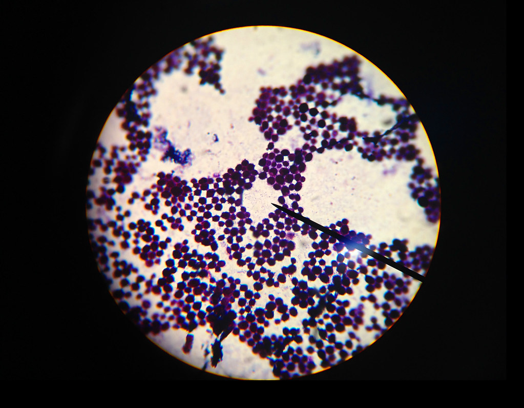 Staphylococcus aureus seen under microscope after Gram's staining
