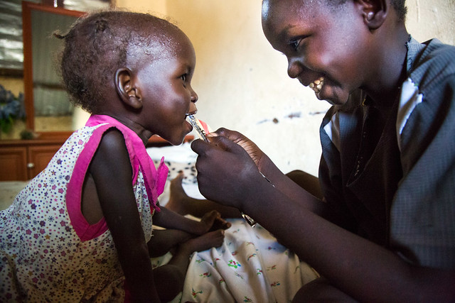 Malnutrition in Juba