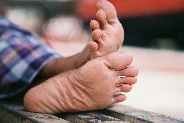 The feet of a homeless man