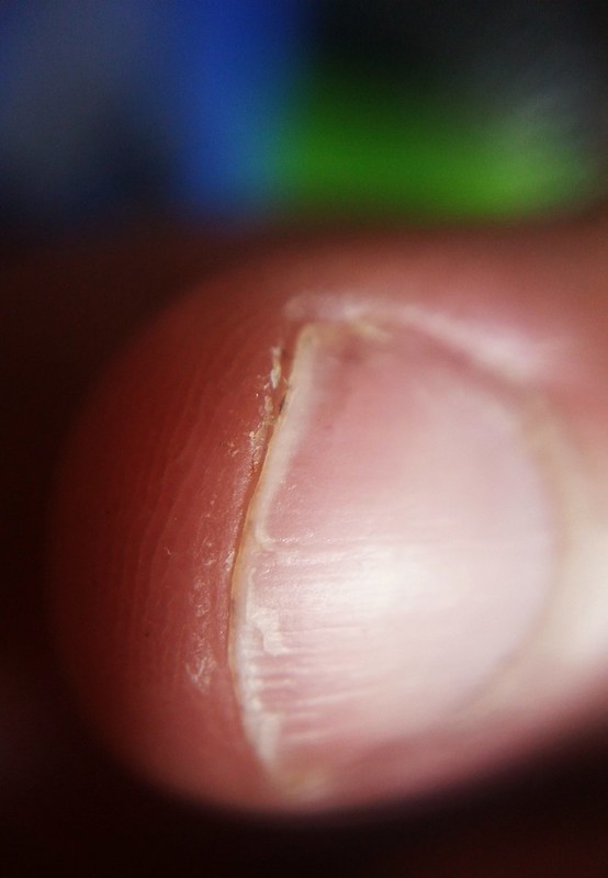 Macro play: extreme close up of my left hand forefinger just before clipping and filing my fingernails. A few millimetres of white nail protrudes past the end of my white-man"s finger.