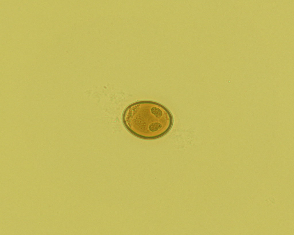 dicrocoelium-dendriticum-egg-in-liver-of-spanish-ibex-a-photo-on