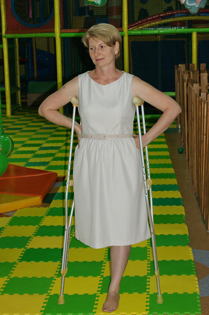 amputee, woman, crutches, onelegged.