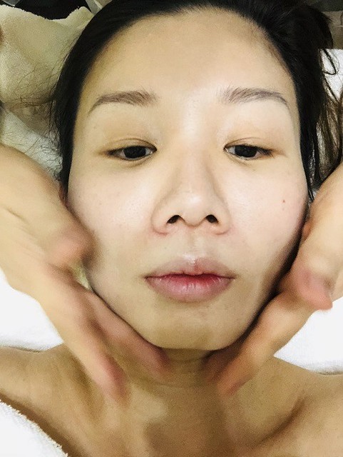 Aldha facial treatment